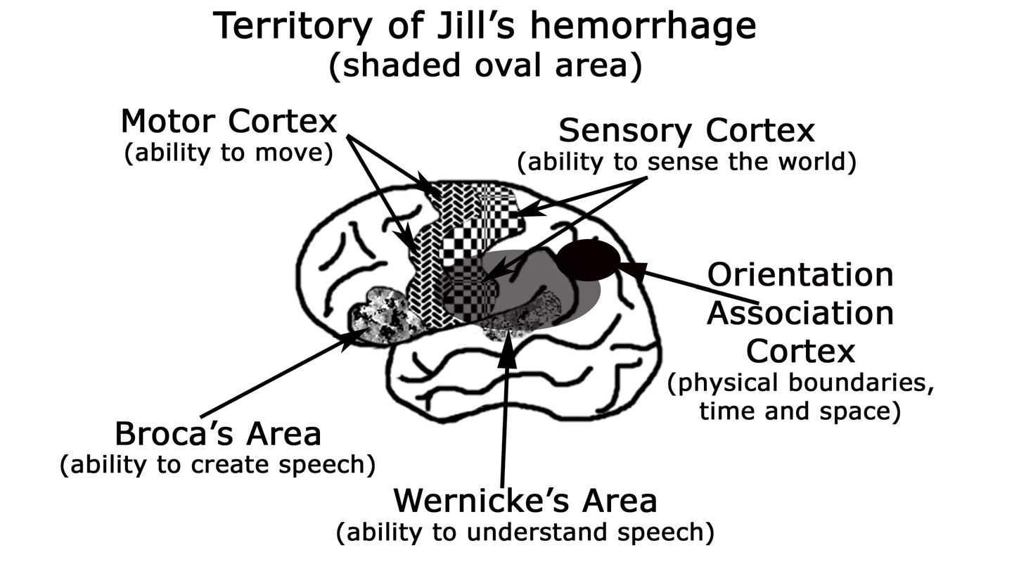 Territory of Jill's hemorrhage: Vùng xuất huyết của Jill